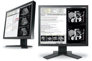 EIZO、19型画面の電子カルテ画像表示モニター「RadiForce MX194」を6月発売