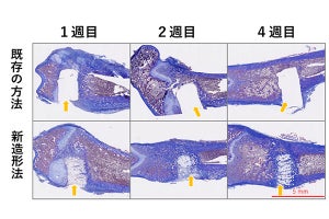 理研ら、3Dプリンタで人工骨を製作- 高い強度と骨置換性