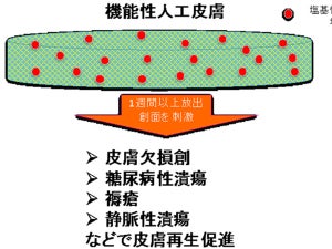 京大発の新たな人工皮膚が製造承認