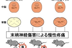 TMDU、グリア細胞の異常が引き起こす慢性疼痛の仕組みを解明