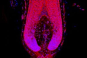 骨粗しょう症治療薬に「発毛」の副次効果 - マンチェスター大が報告