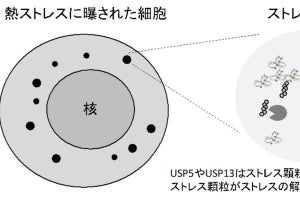 東工大、ALSの一因ともなるストレス顆粒の消失を促す酵素を発見