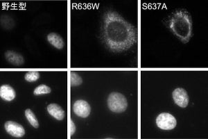 TMDUら、拡張型心筋症の病因が分子ばねタンパク質の発現に影響するしくみを解明