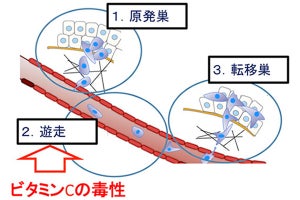 ビタミンCががん転移を抑制するメカニズムに新知見 - 東京工科大