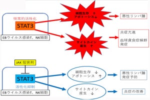 慢性活動性EBウイルス感染症の治療標的分子を同定 - 治療応用に期待