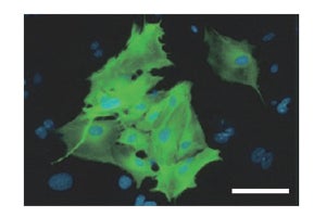 ヒトiPS細胞から心筋細胞を高効率に誘導する新技術