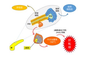 膵内分泌腫瘍の肝移転の原因を遺伝子レベルで解明 - TMDU