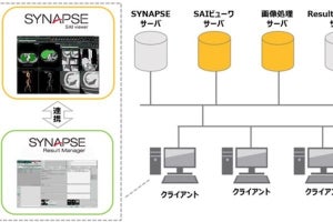 富士フイルム、画像診断ワークフローを支援するAIプラットフォームを開発