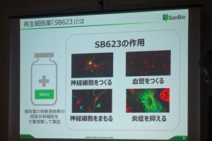 サンバイオ、2020年に製薬企業への変貌を目指すことを表明