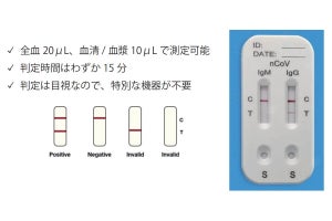 TKResearch、イムノクロマト法の新型コロナウイルス向け研究用試薬を発売