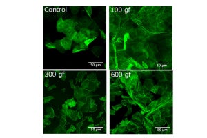 ウイルス感染リスクが高まる長時間のマスク着用 - 摩擦刺激で皮膚が脆弱化