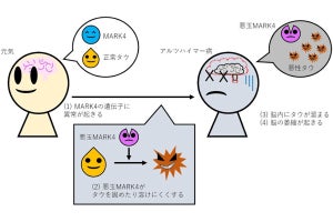 アルツハイマー病の治療法確立へ向け前進、都立大などが仕組みの一部を解明