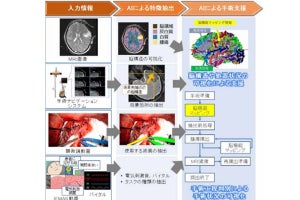 5Gを活用して大容量手術データをAIが解析する実証実験 ‐ドコモら三者