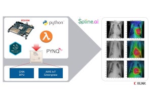 Xilinx、医療機器向けの新リファレンスプラットフォームを発表