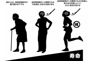 脳への糖の取込みの促進と食生活の改善が健康寿命を延ばす - 都立大が解明