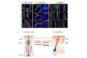 「器官置換再生医療」にもつながる成果　理研、毛包幹細胞の培養方法を確立