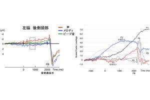 ヒトの脳が他者の声を聞く前から準備して待ち構えていることを東工大が解明