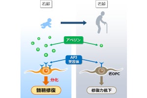 加齢で衰えた脳の神経回路の修復力を回復させる仕組みをNCNPなどが発見