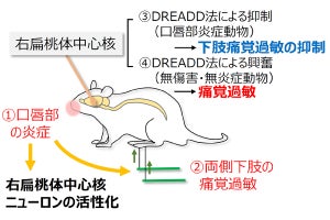 慢性疼痛の原因はストレスや不安に対する脳の活動の可能性、慈恵医大が確認