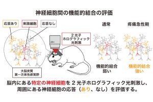 痛みを感じた時の脳内の神経回路がどう変化しているのかを名大などが解明