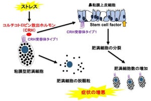 鼻粘膜内のアレルギー発症にストレスホルモンが関与、大阪市大が確認