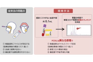 PCRと同程度の精度で医療従事者の感染リスクが低い検査手法を熊本大が開発