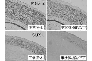 甲状腺ホルモン不足が脳の発達障害を引き起こす仕組みの一部を東北大が解明