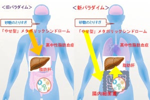 メタボにつながる脂質代謝の異常は腸内環境の変化が原因、名大が解明