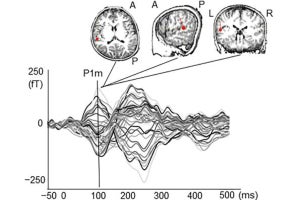 自閉スペクトラム症児の一部は、音への脳反応が発達している - 金大が確認