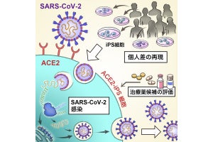 京大、iPS細胞で新型コロナ感染の個人差を再現することに成功