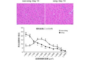 神戸大、肉離れなどの重い筋損傷後のアイシングは筋再生を遅らせる事を確認