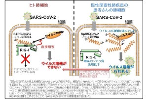 北大、細胞内に侵入した新型コロナウイルスを認識するセンサー遺伝子を発見