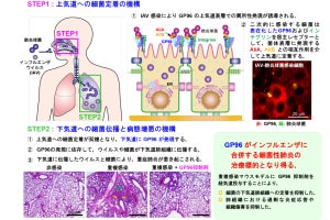 インフルエンザへの感染が細菌性肺炎を誘発する仕組みを阪大などが解明