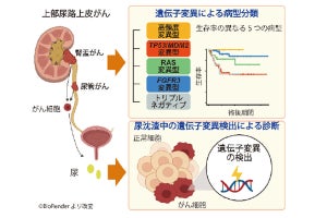 京大など、上部尿路上皮がんの分子分類手法と新規分子診断手法を開発