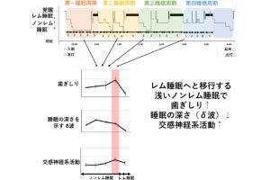 阪大、子どもの歯ぎしりが睡眠周期に合わせて繰り返し増減することを確認