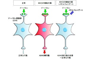 免疫応答の重要因子の欠損が注意欠如・多動性を引き起こす、浜松医大などが確認