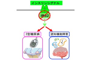 糖尿病患者のインスリン作用経路分子の欠損変異に認知機能障害の誘導を確認