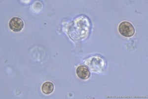 サンゴの培養細胞が褐虫藻を取り込んだ瞬間を観察、白化現象の解明に期待