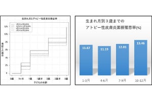 山梨大、エコチル調査でアトピー性皮膚炎は10～12月生まれが多いことを確認