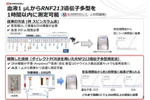 島津製作所と国循、東アジア特有の脳血管障害リスク遺伝子の検出技術を開発