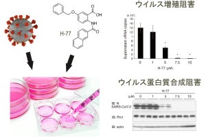 新型コロナの増殖を「プロリン異化酵素阻害化合物」が抑制、広島大などが発見