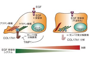 なぜ年を取ると皮膚の再生能は低下するのか？、TMDUなどが原因を解明