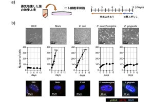 大腸がんの発症や進展などとの強い関連性が示唆される腸内細菌を阪大が発見