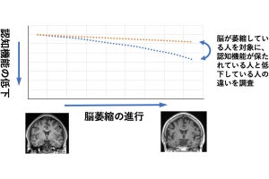 脳が萎縮しても認知機能を維持できる人の特徴は何か？、京大が調査