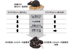 妊娠中の高カロリー食摂取が子供の肥満などの原因の一因に、九大が仕組みを解明