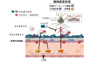 砂糖の過剰摂取は統合失調症や双極性障害の発症要因となる、NCNPが確認