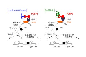 認知症の原因タンパク質が脳の炎症を引き起こす仕組みを医科歯科大が解明