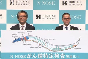 線虫を用いて早期すい臓がんの特定に成功、2022年の実用化目指す - HIROTSU