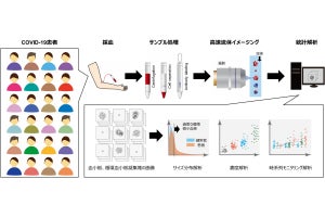 多くの新型コロナ患者の体内では血小板の凝集塊が巡っている、東大が確認