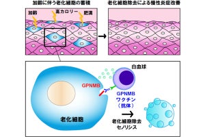 順天堂大、老化細胞を除去できるワクチンを開発